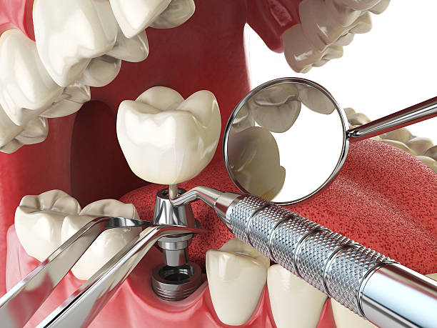Best Urgent Dental Care for Toothache in Buckhorn, CA